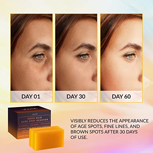 VALITIC Kojic Acid Dark Spot Remover Soap Bars with Vitamin C, Retinol, Collagen, Turmeric - Original Japanese Complex Infused with Hyaluronic Acid, Vitamin E, Shea Butter, Castile Olive Oil (2 Pack)-UPStoxs