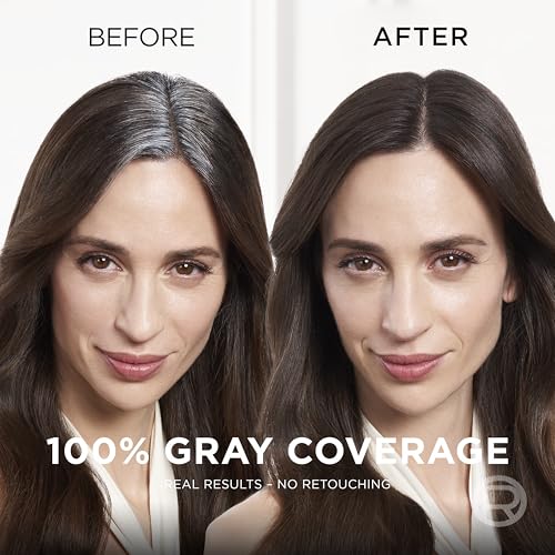 L'Oreal Paris Root Cover Up Temporary Gray Concealer Spray, Hair Color Spray with Filling & Thickening Coverage, Dark Brown, Packaging May Vary-UPStoxs